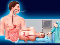 Endoscopia