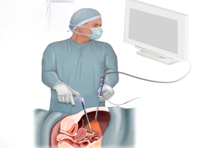 cirurgia_aparelho_digestivo